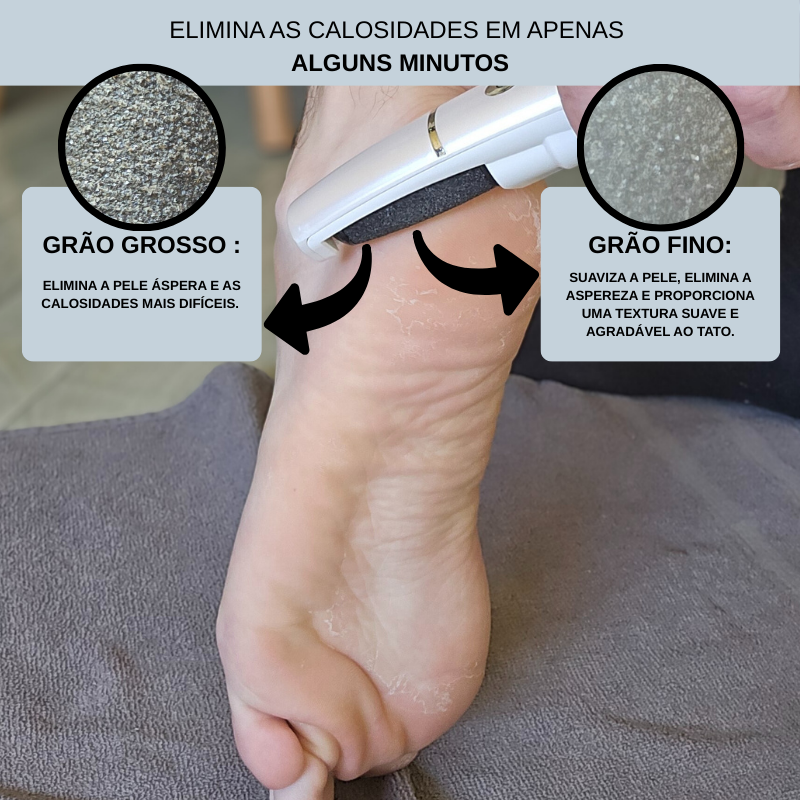 Lixadeira anti-calo